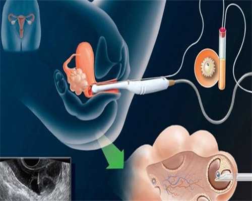单角子宫三代试管成功指南与正规助孕中心选择