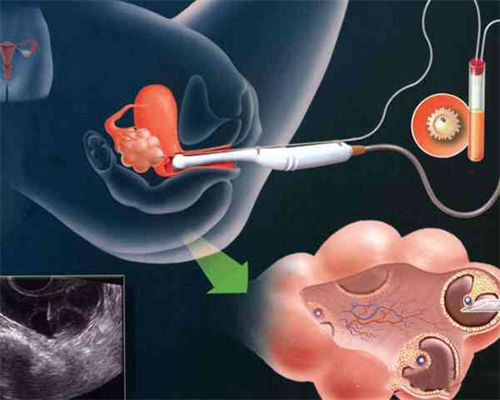 沈阳试管医院选择指南：避免受骗与医生排名解析